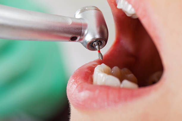 Best Emergency Root Canal Therapy in Hondo, TX